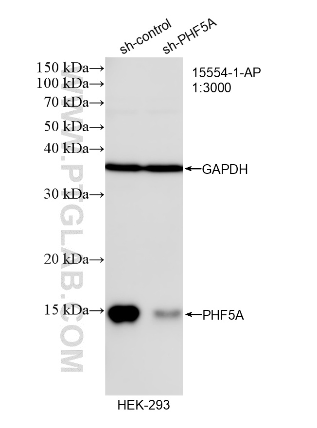 WB result of PHF5A antibody (15554-1-AP; 1:3000; incubated at room temperature for 1.5 hours) with sh-Control and sh-PHF5A transfected HEK-293 cells. WB analysis of HEK-293 using 15554-1-AP