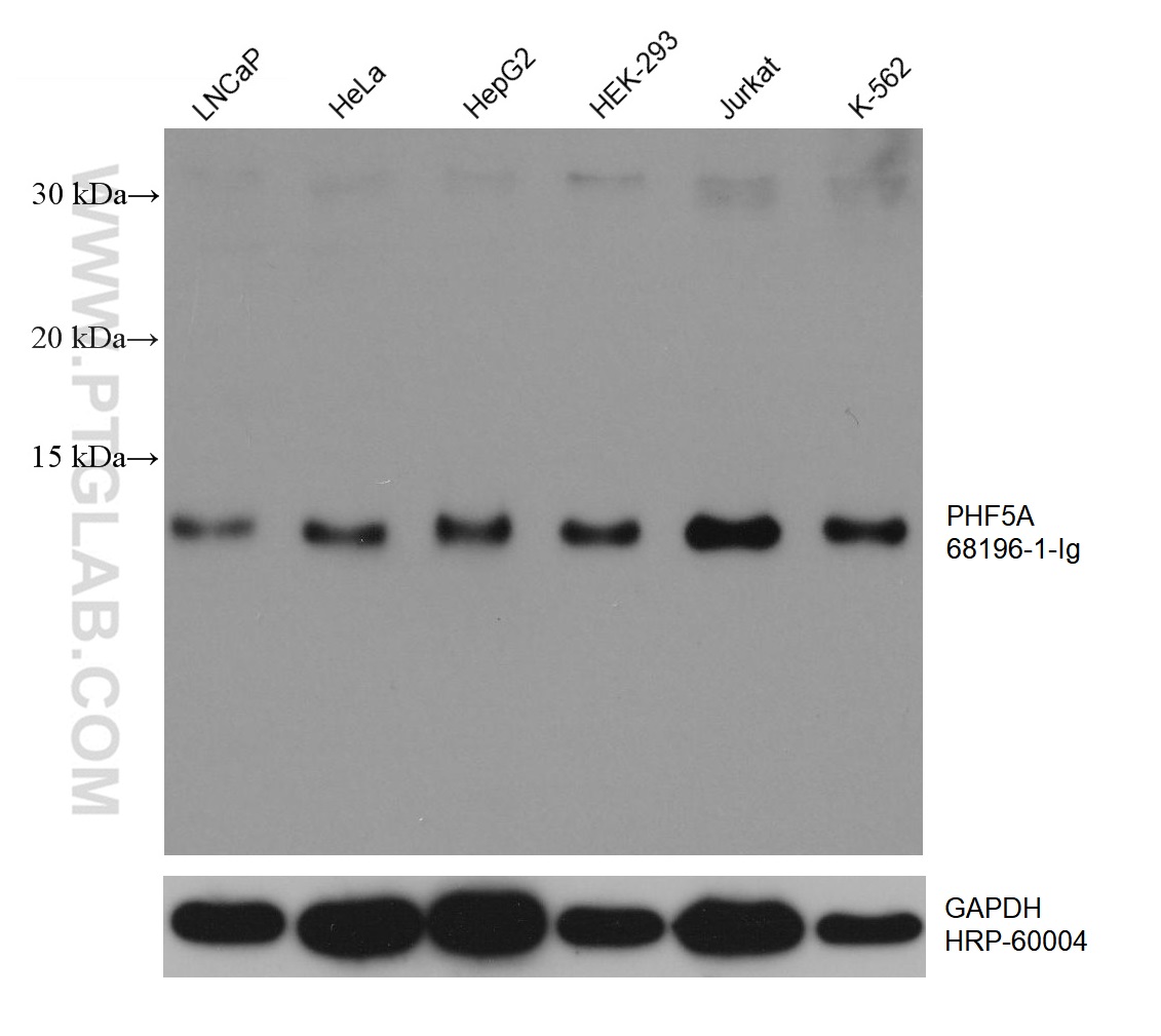 WB analysis using 68196-1-Ig (same clone as 68196-1-PBS)