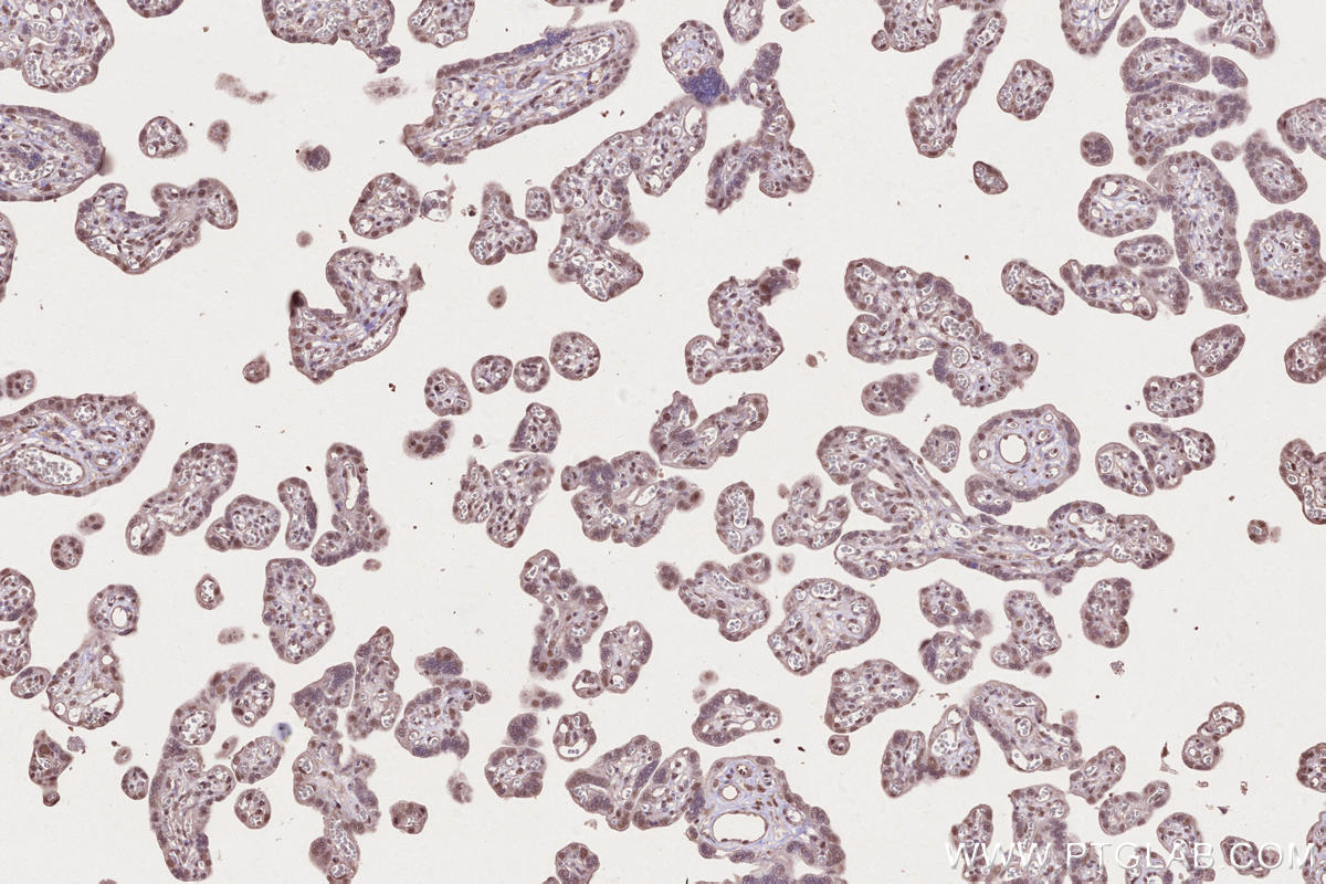IHC staining of human placenta using 51062-1-AP