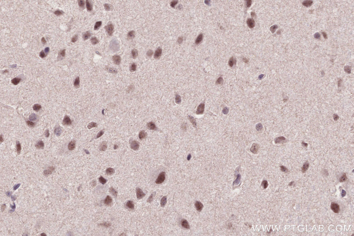 IHC staining of mouse brain using 51062-1-AP