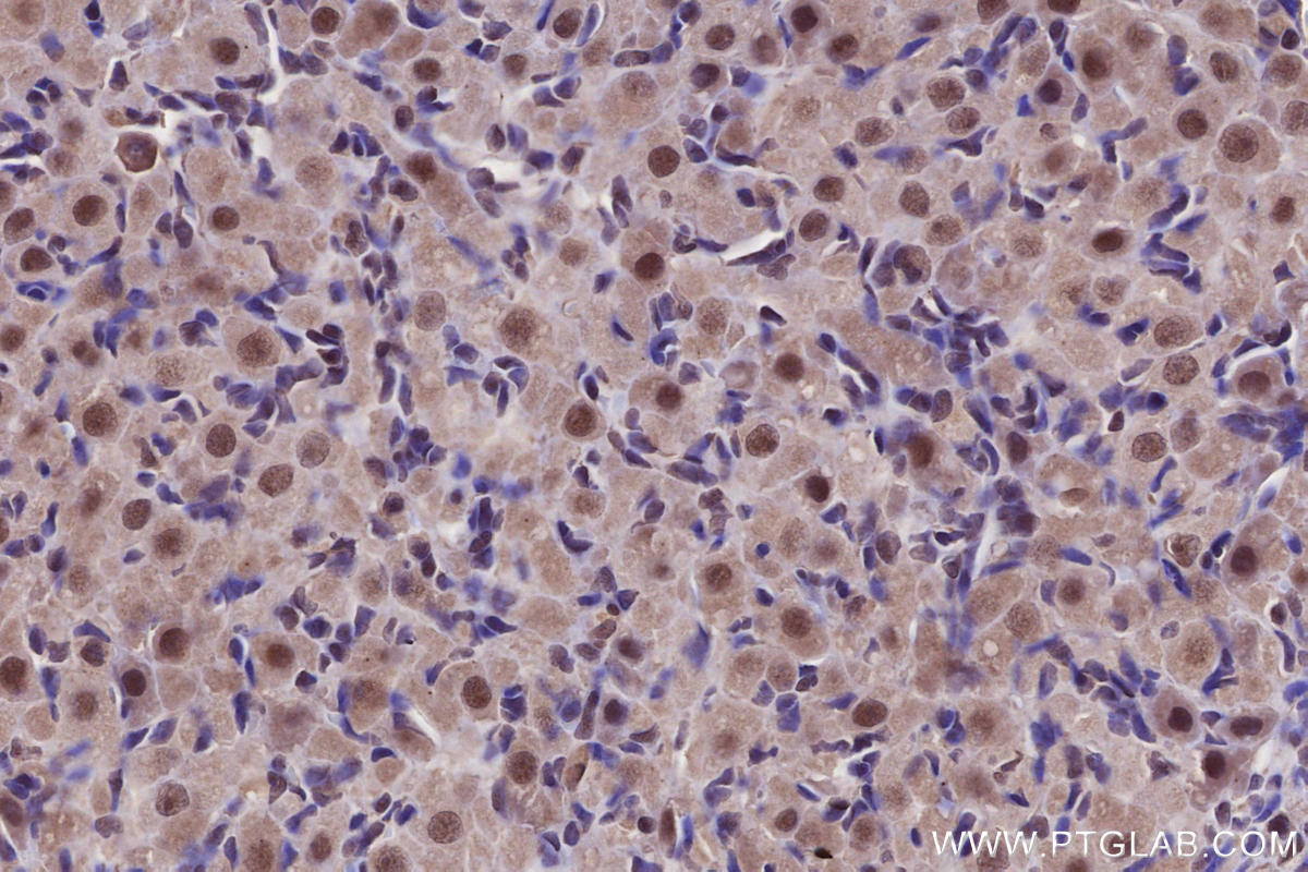 IHC staining of rat ovary using 51062-1-AP