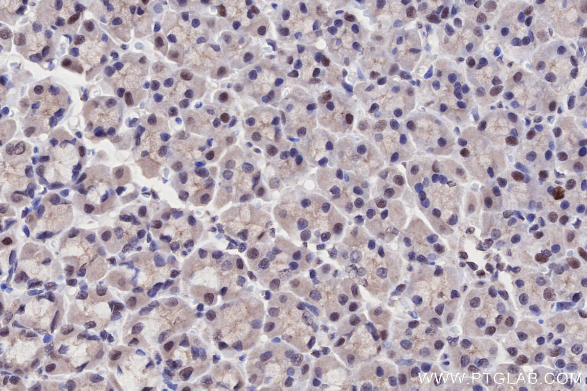 IHC staining of rat stomach using 51062-1-AP