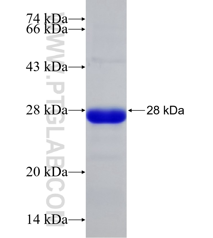 PHF8 fusion protein Ag30714 SDS-PAGE PHF8 fusion protein Ag30714 SDS-PAGE