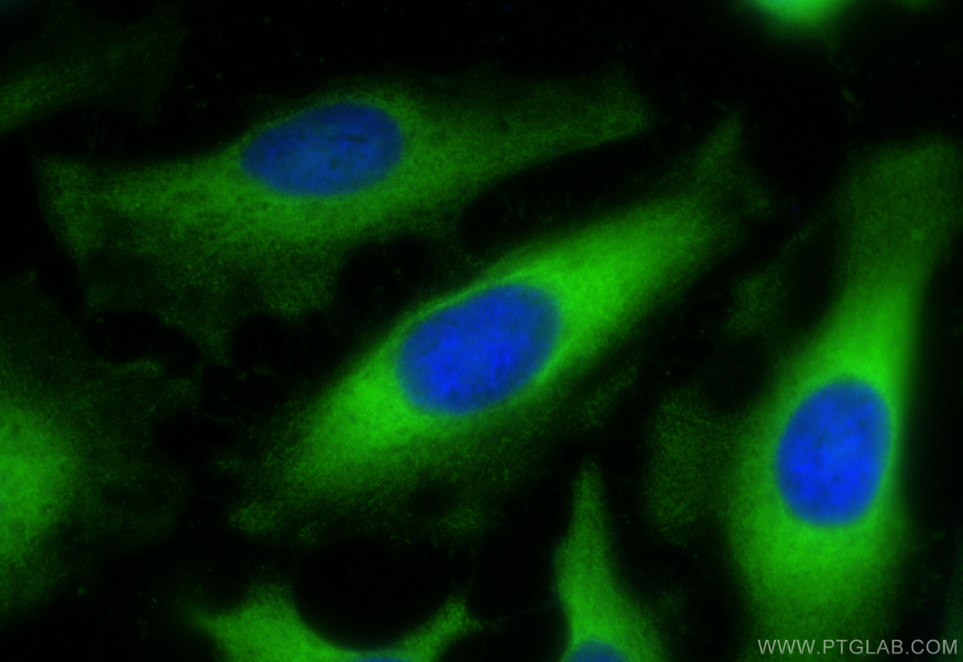 IF Staining of HeLa using 14719-1-AP