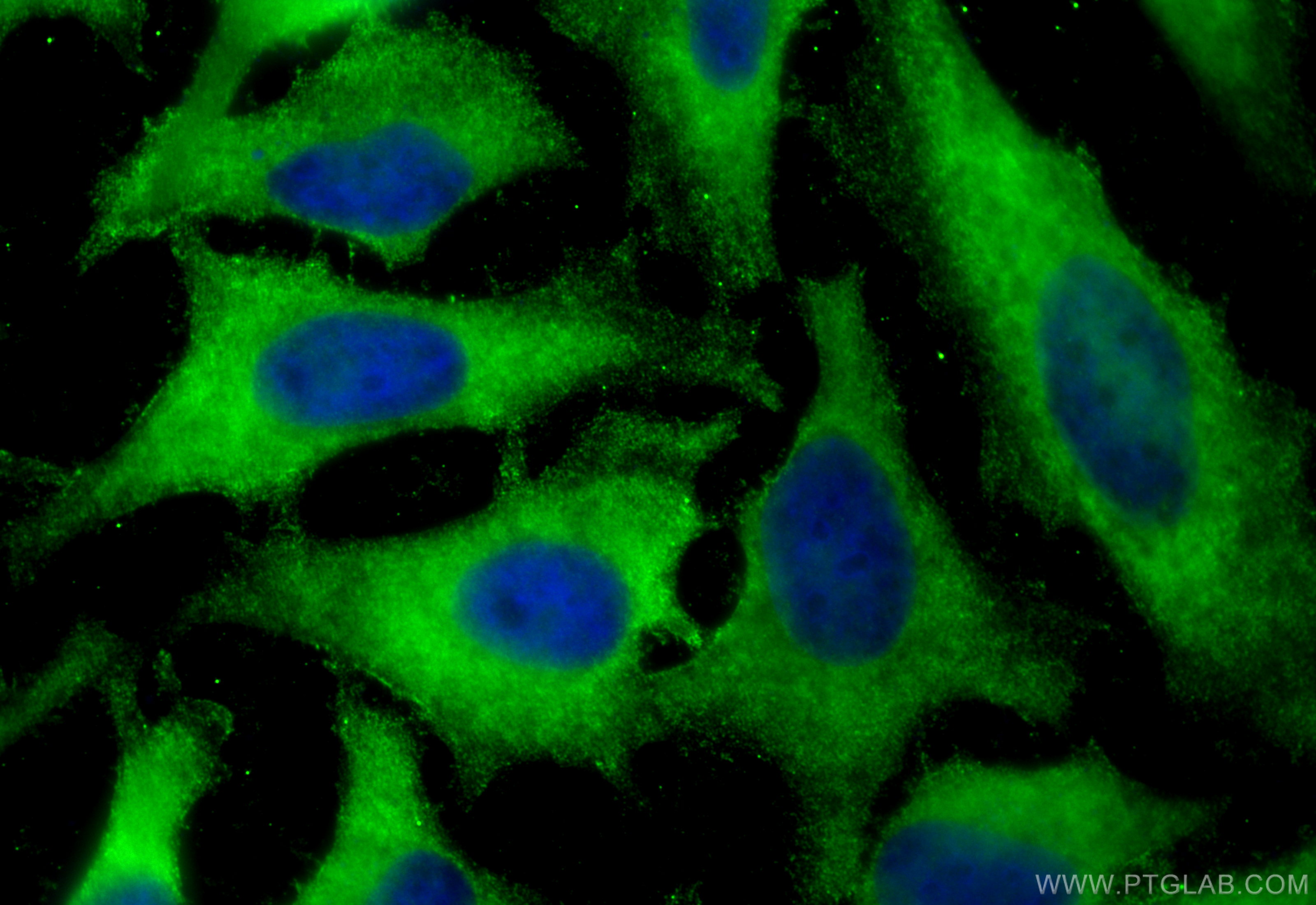 IF Staining of HeLa using 67591-1-Ig