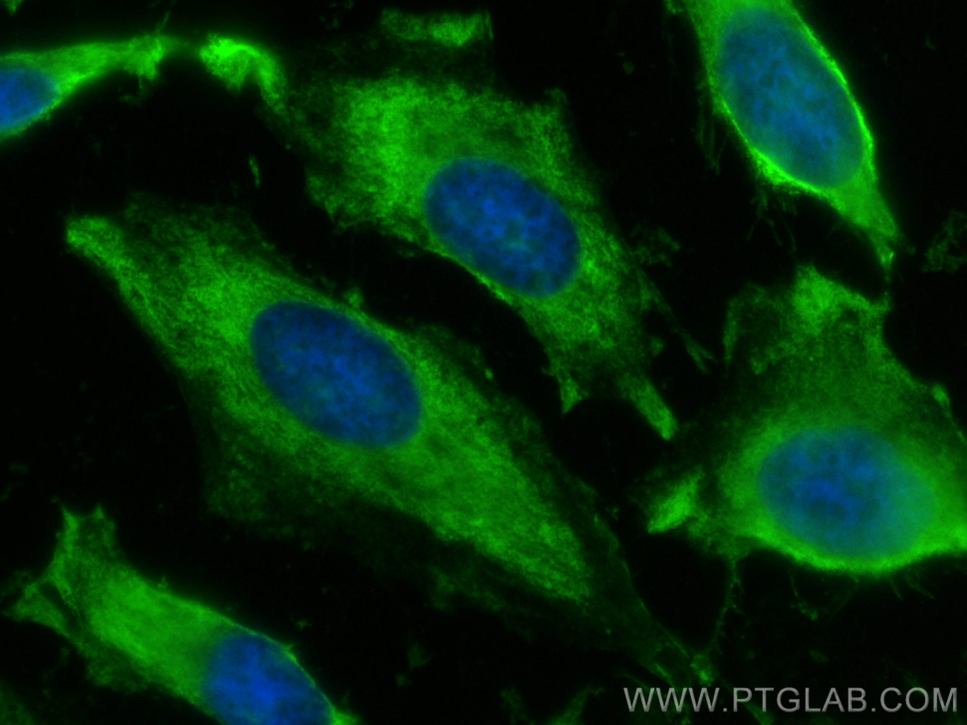 IF Staining of HeLa using CL488-67591