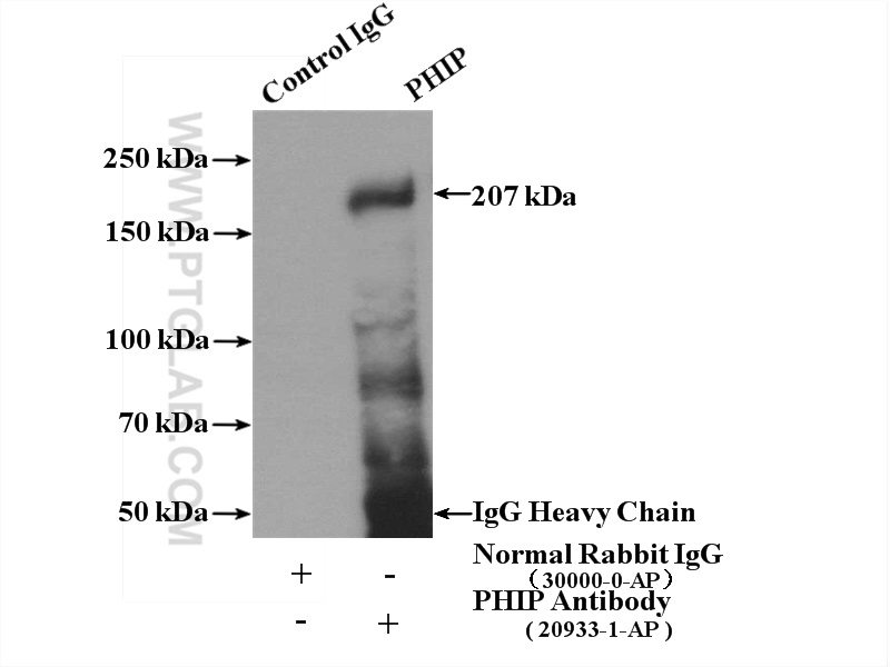 IP experiment of A375 using 20933-1-AP