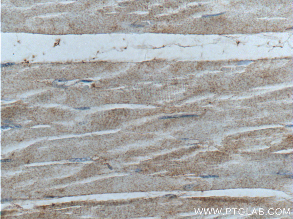 IHC staining of human skeletal muscle using 24279-1-AP