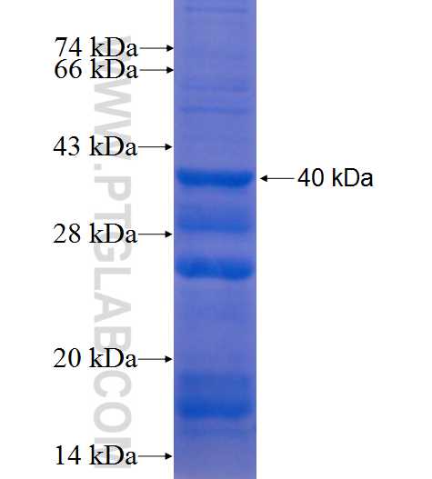 PHKA2 fusion protein Ag9473 SDS-PAGE