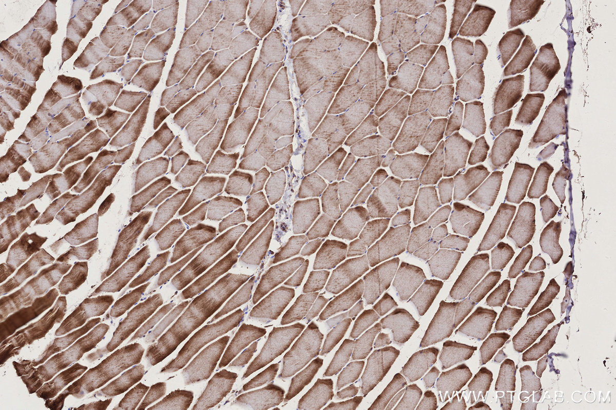 IHC staining of mouse skeletal muscle using 13400-1-AP IHC staining of mouse skeletal muscle using 13400-1-AP