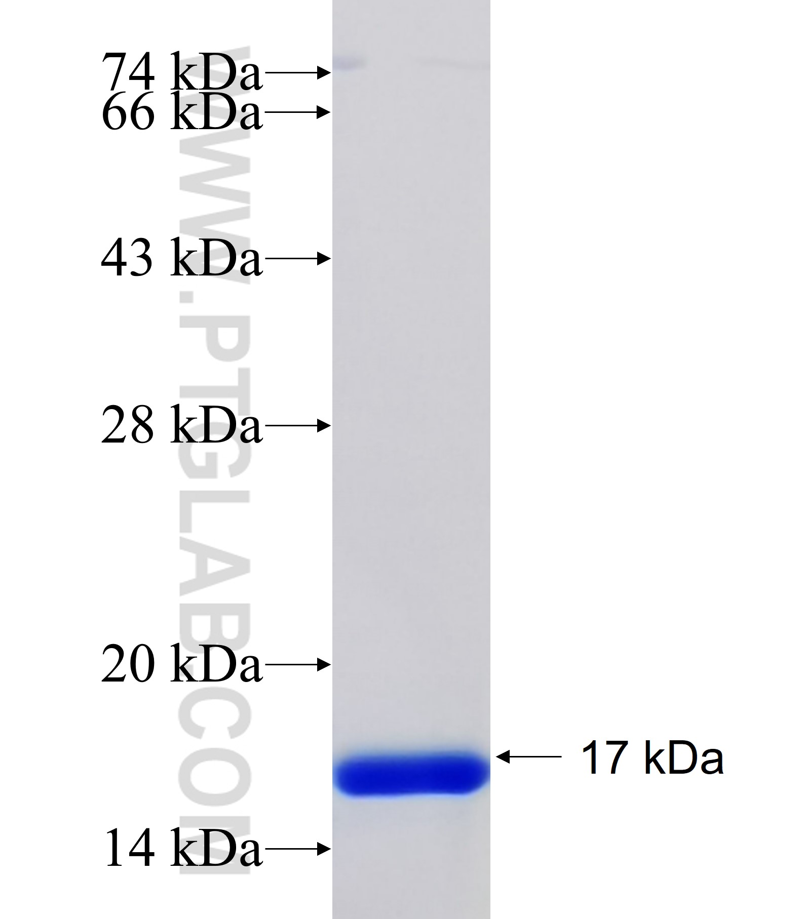 PHKG1 fusion protein Ag34236 SDS-PAGE PHKG1 fusion protein Ag34236 SDS-PAGE