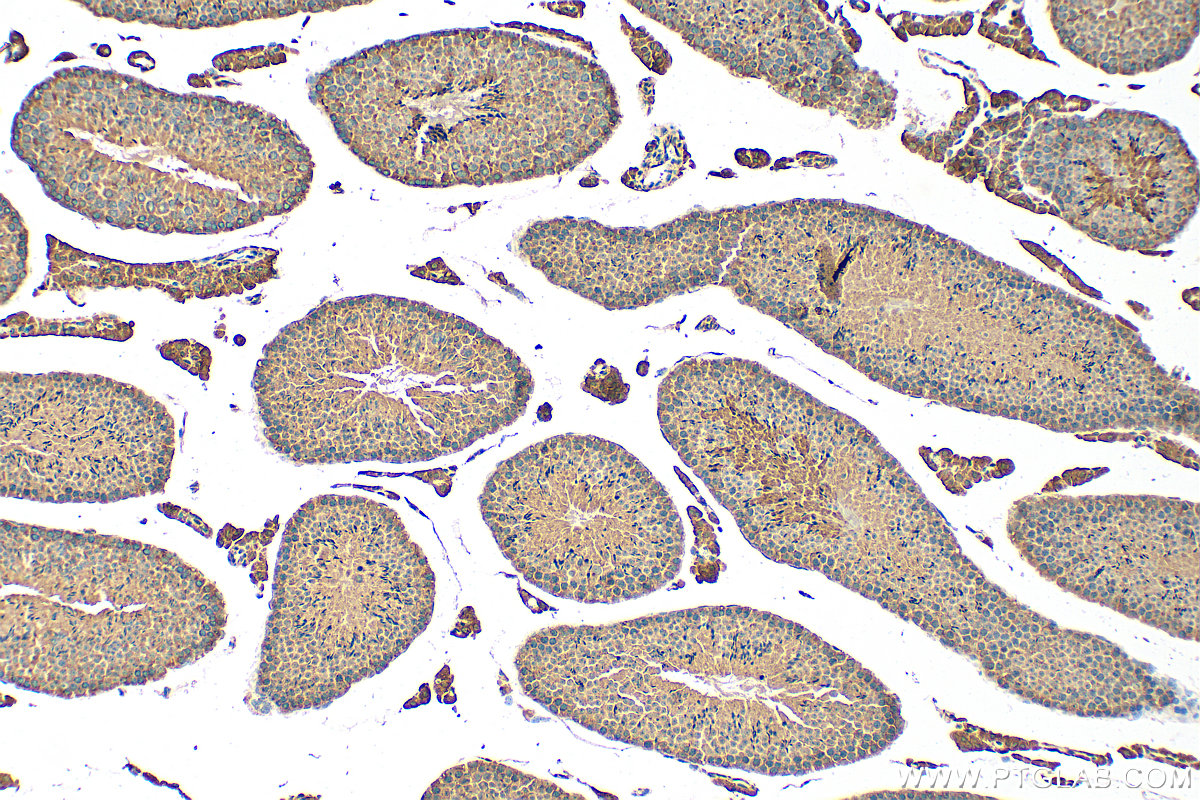 IHC staining of mouse testis using 15109-1-AP