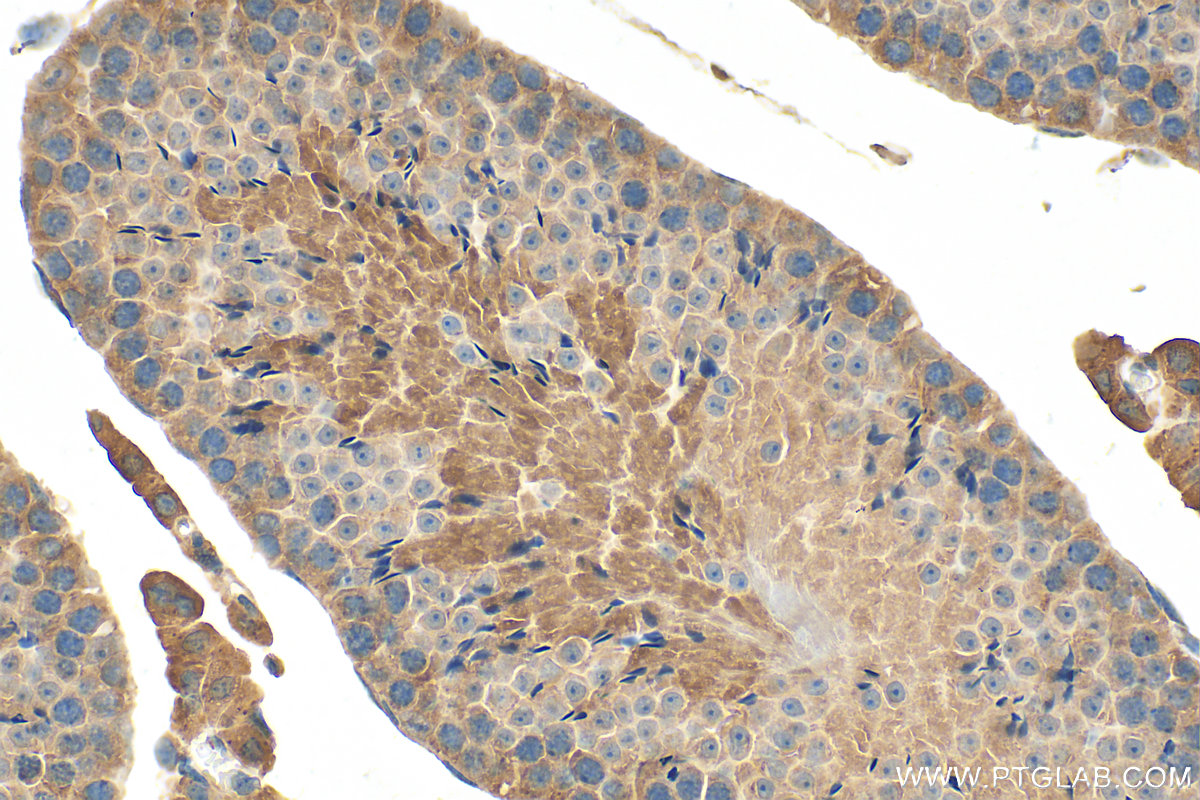 IHC staining of mouse testis using 15109-1-AP