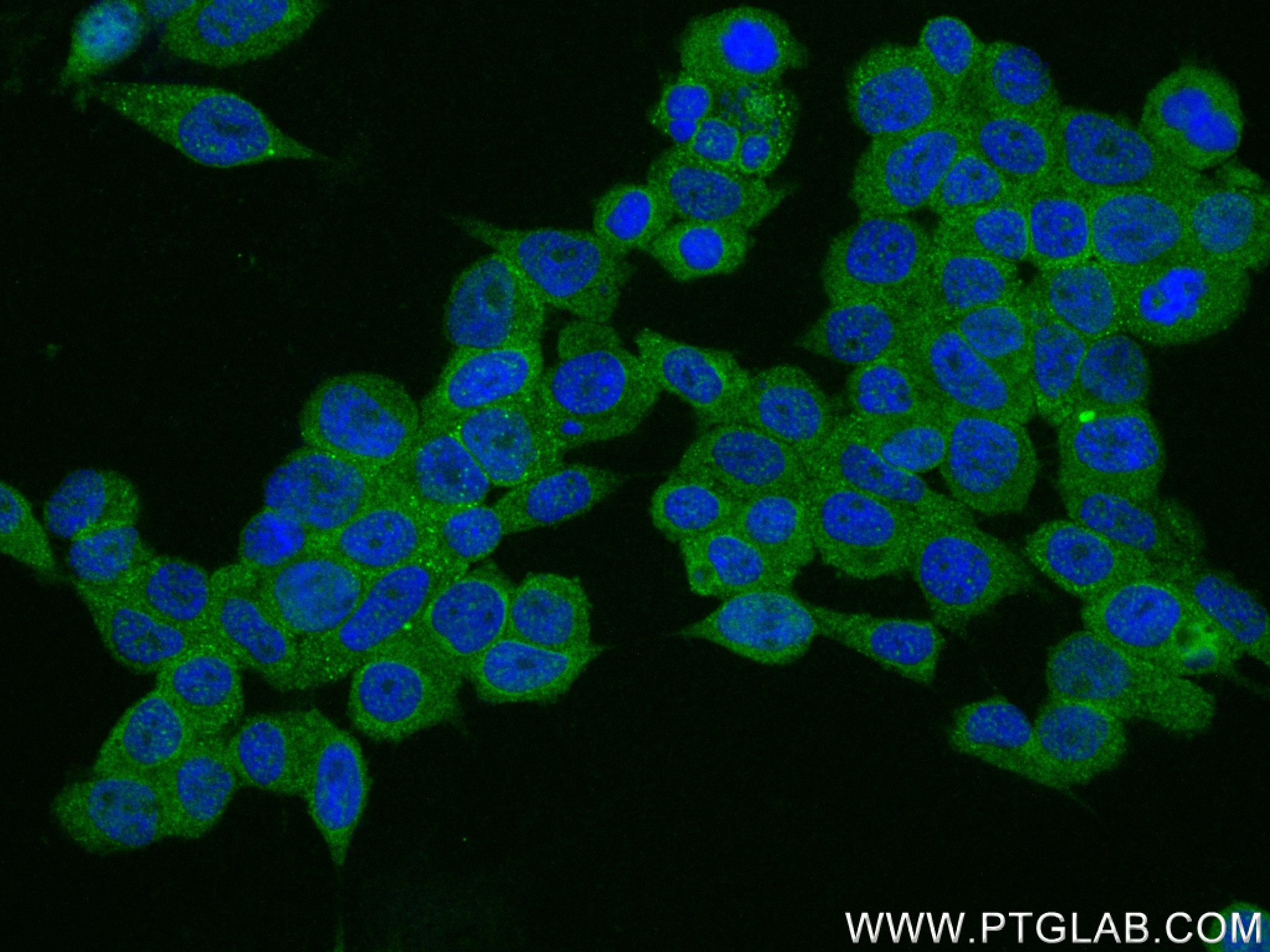 IF Staining of HEK-293 using 83663-2-RR (same clone as 83663-2-PBS)