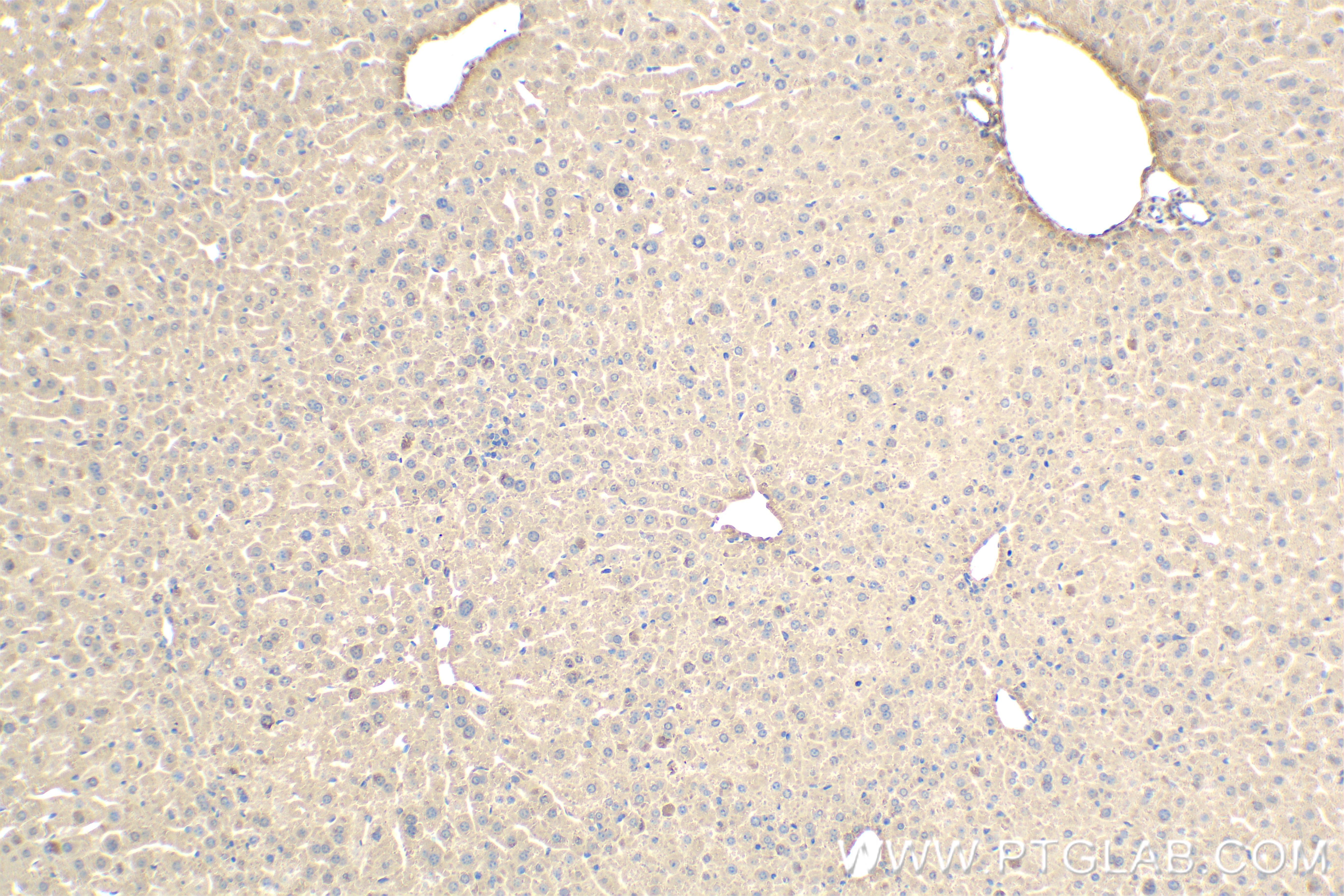 IHC staining of mouse liver using 83663-2-RR (same clone as 83663-2-PBS)