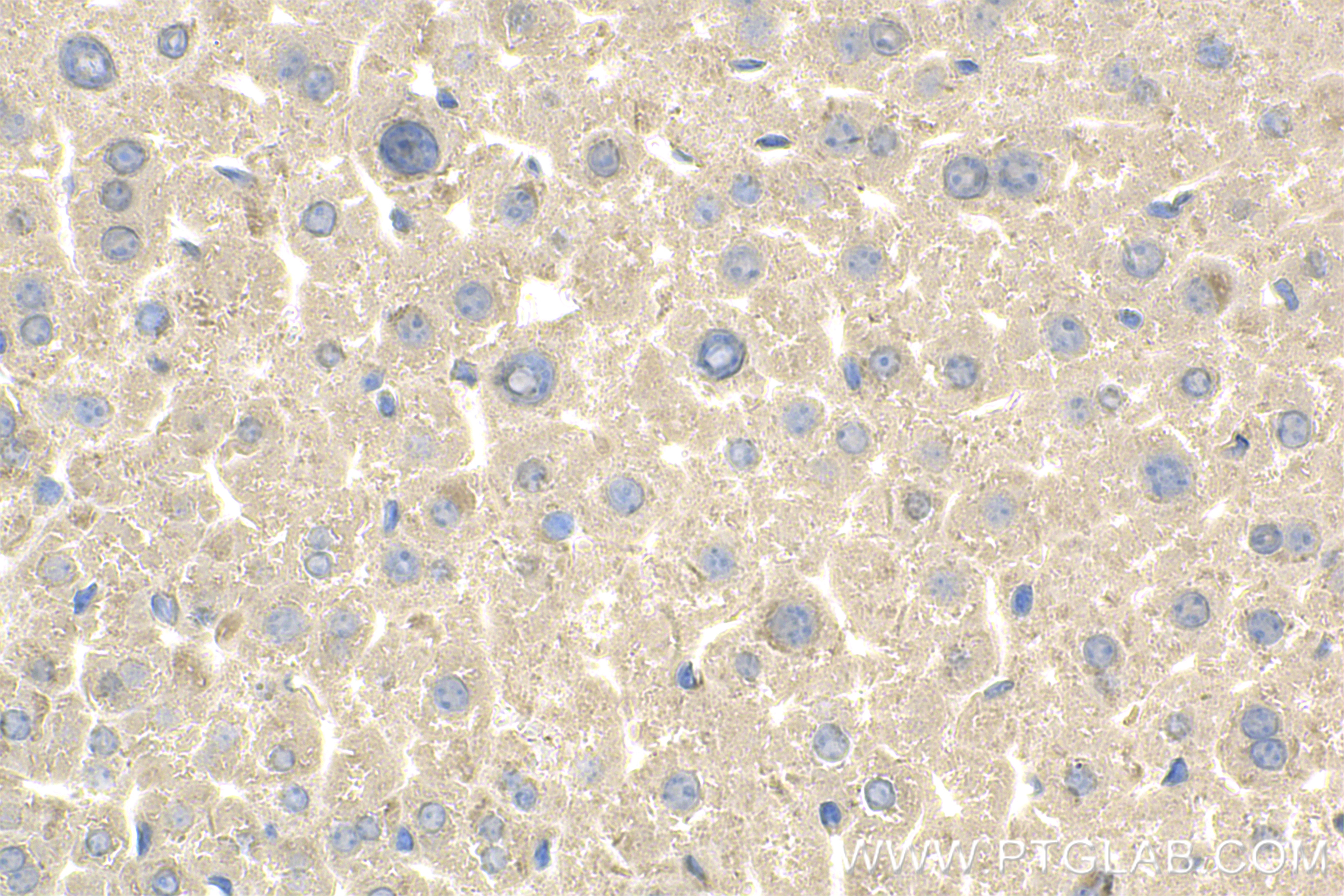 IHC staining of mouse liver using 83663-2-RR (same clone as 83663-2-PBS)