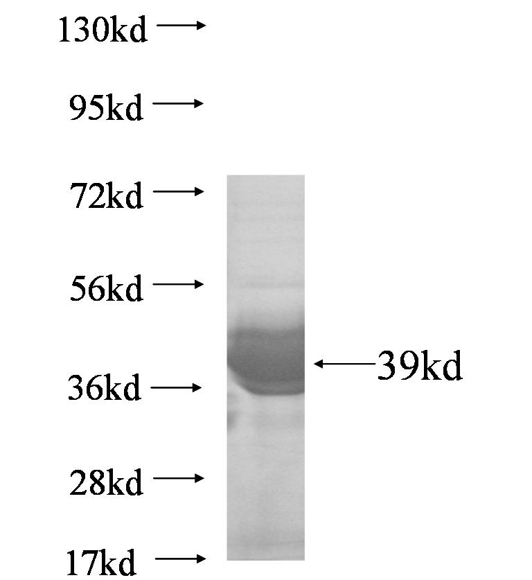 PHKG2 fusion protein Ag7139 SDS-PAGE
