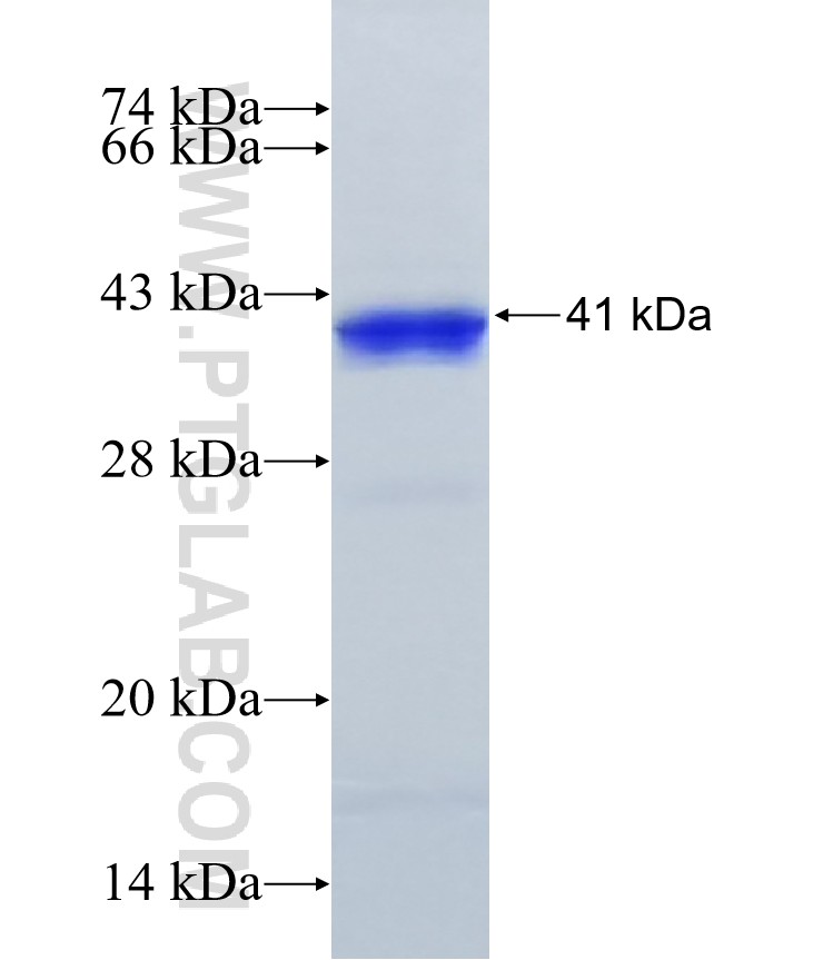 PHKG2 fusion protein Ag7139 SDS-PAGE