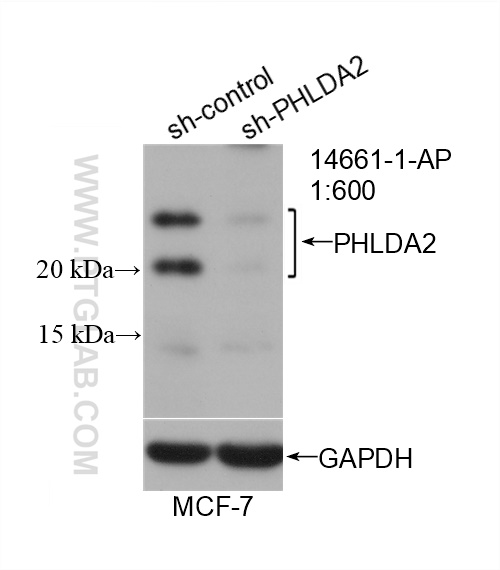 WB analysis of MCF-7 using 14661-1-AP