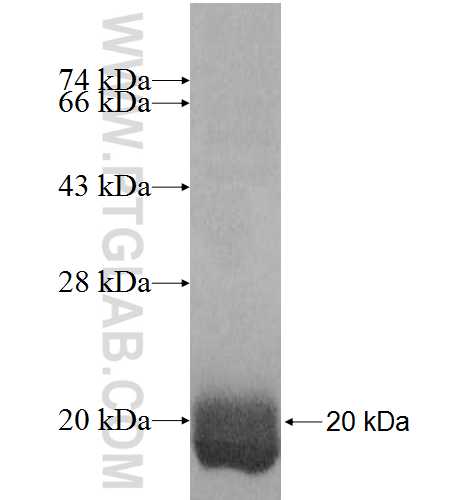 PHLDA3 fusion protein Ag8886 SDS-PAGE PHLDA3 fusion protein Ag8886 SDS-PAGE
