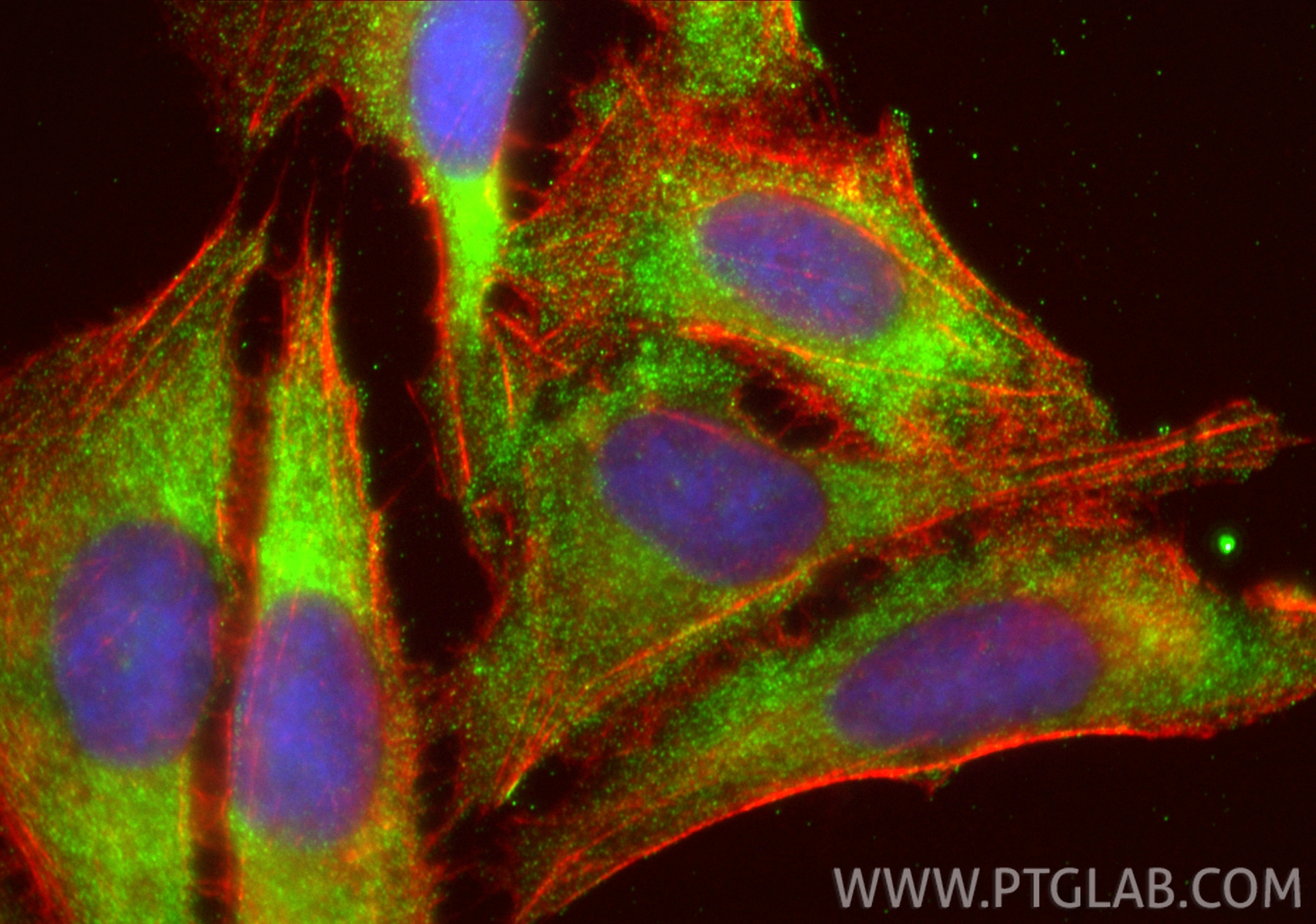 IF Staining of U2OS using 33225-1-AP (same clone as 33225-1-PBS)