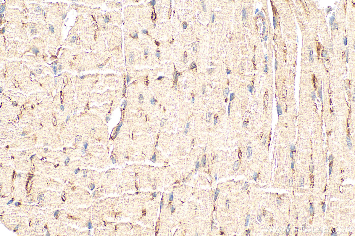 IHC staining of mouse heart using 33225-1-AP (same clone as 33225-1-PBS)