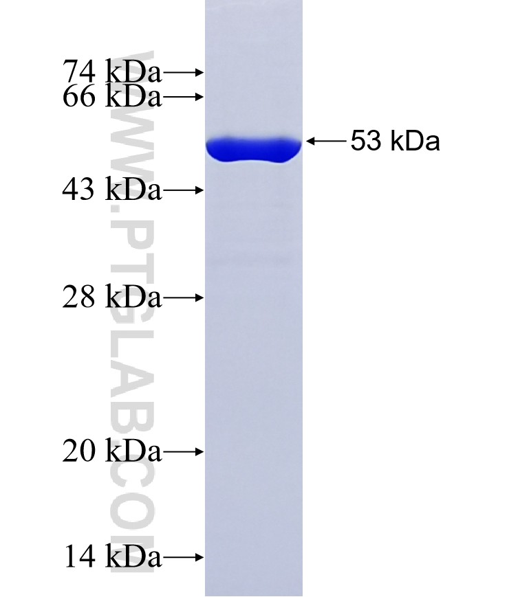 PHLDB1 fusion protein Ag37254 SDS-PAGE PHLDB1 fusion protein Ag37254 SDS-PAGE