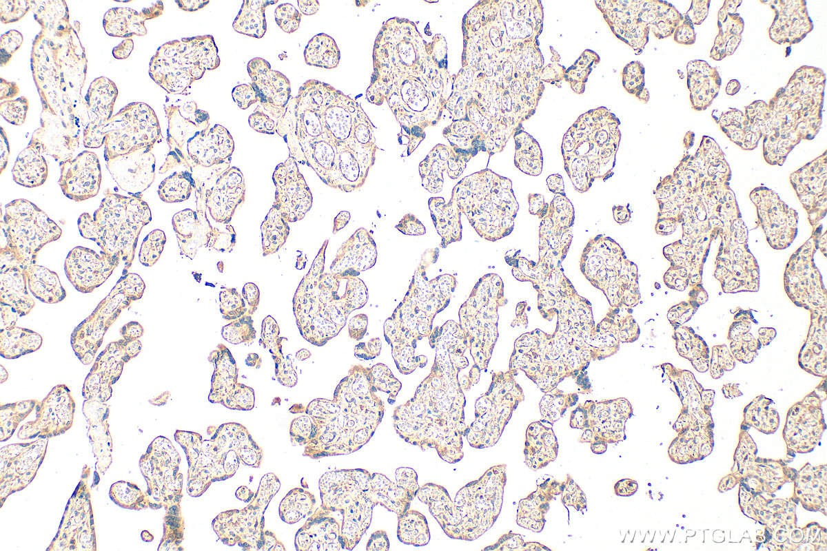 IHC staining of human placenta using 27940-1-AP