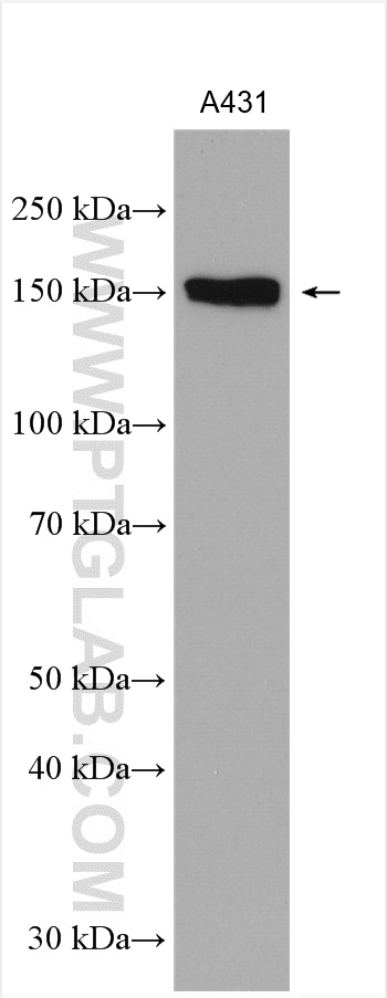 WB analysis of A431 using 27940-1-AP