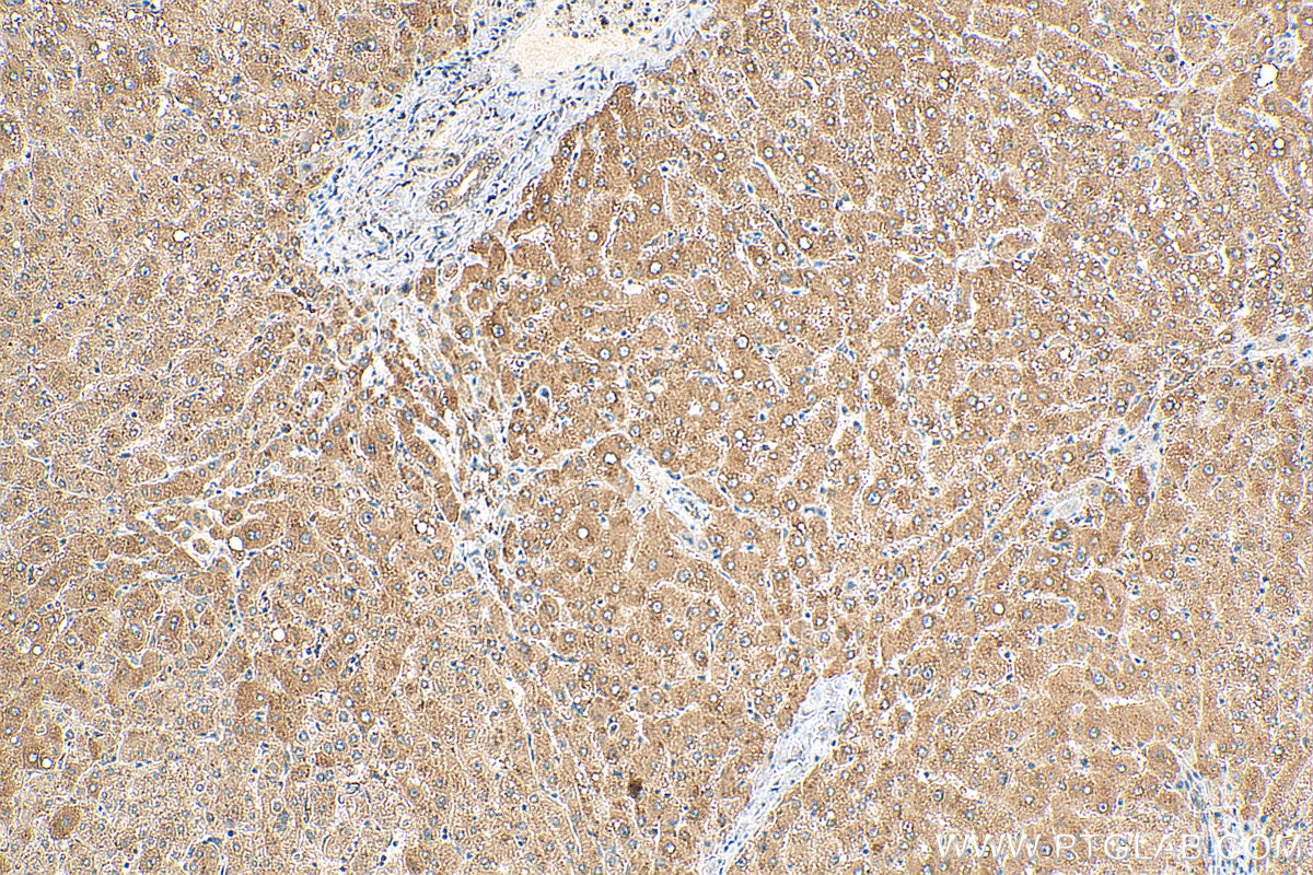 IHC staining of human liver using 22789-1-AP