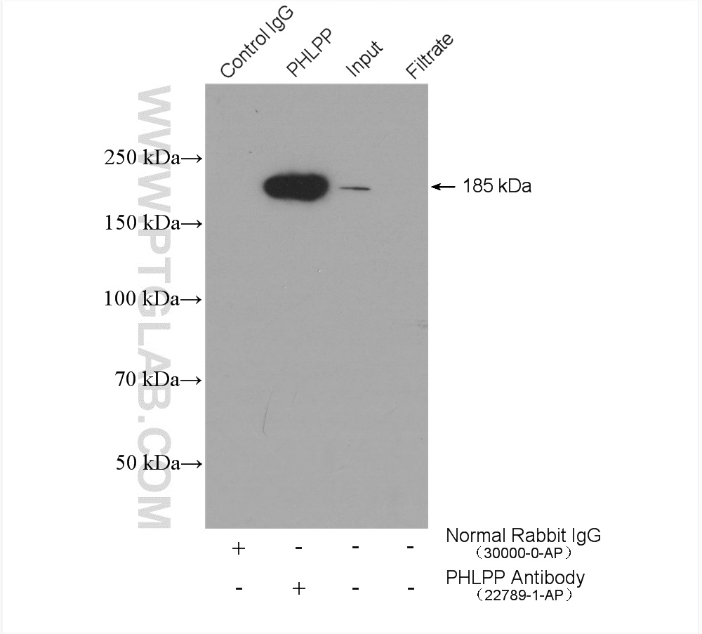 IP experiment of mouse brain using 22789-1-AP