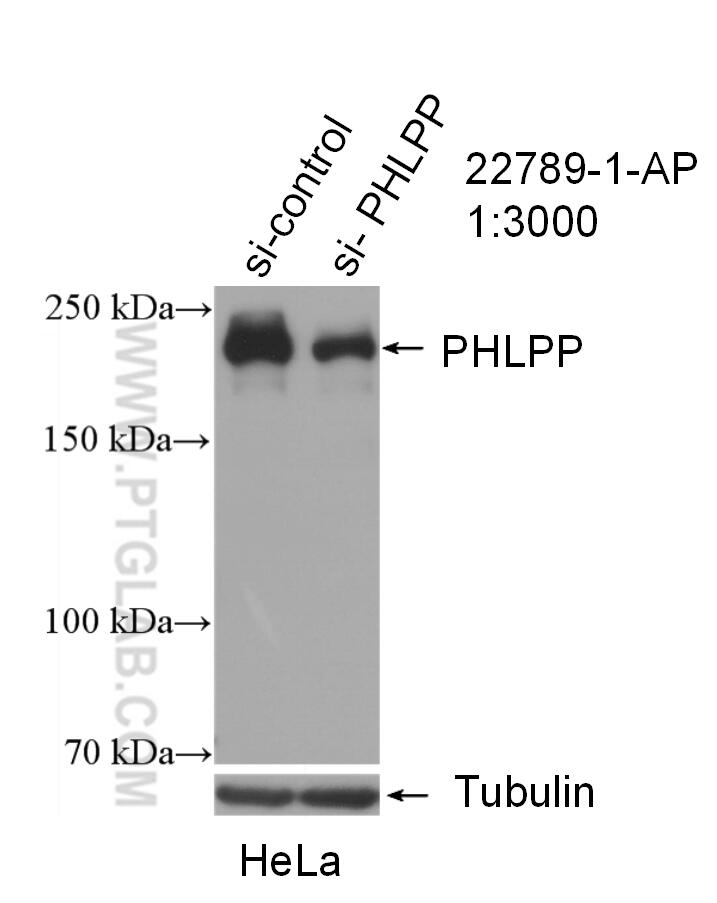 WB analysis of HeLa using 22789-1-AP