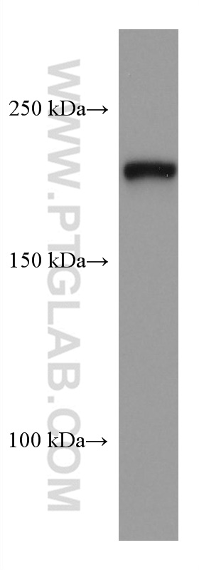 WB analysis of mouse brain using 67640-1-Ig