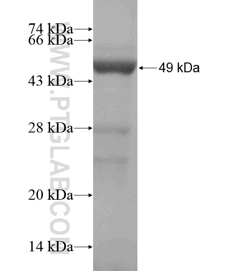 PHLPPL fusion protein Ag19198 SDS-PAGE PHLPPL fusion protein Ag19198 SDS-PAGE