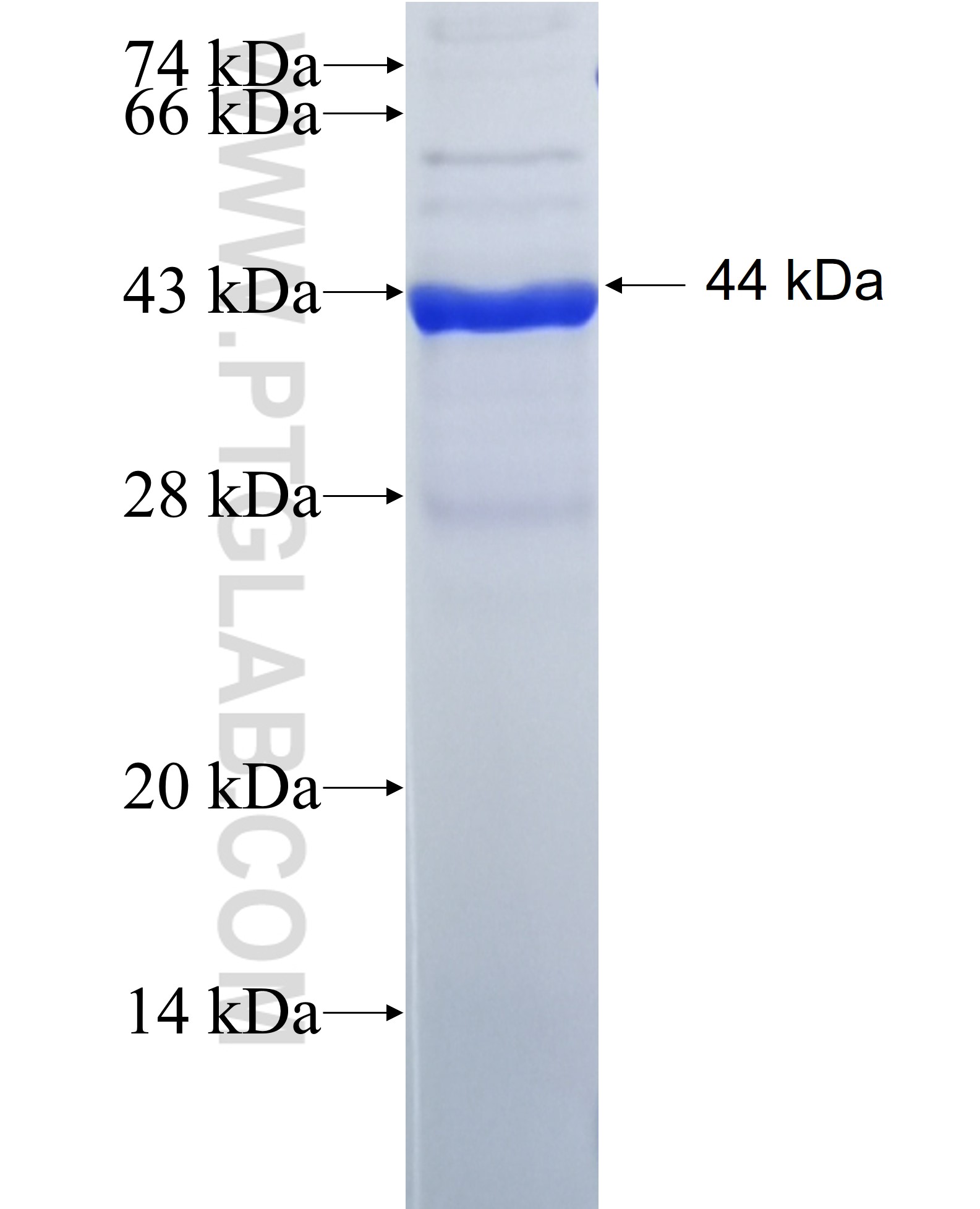 PHOSPHO1 fusion protein Ag26949 SDS-PAGE