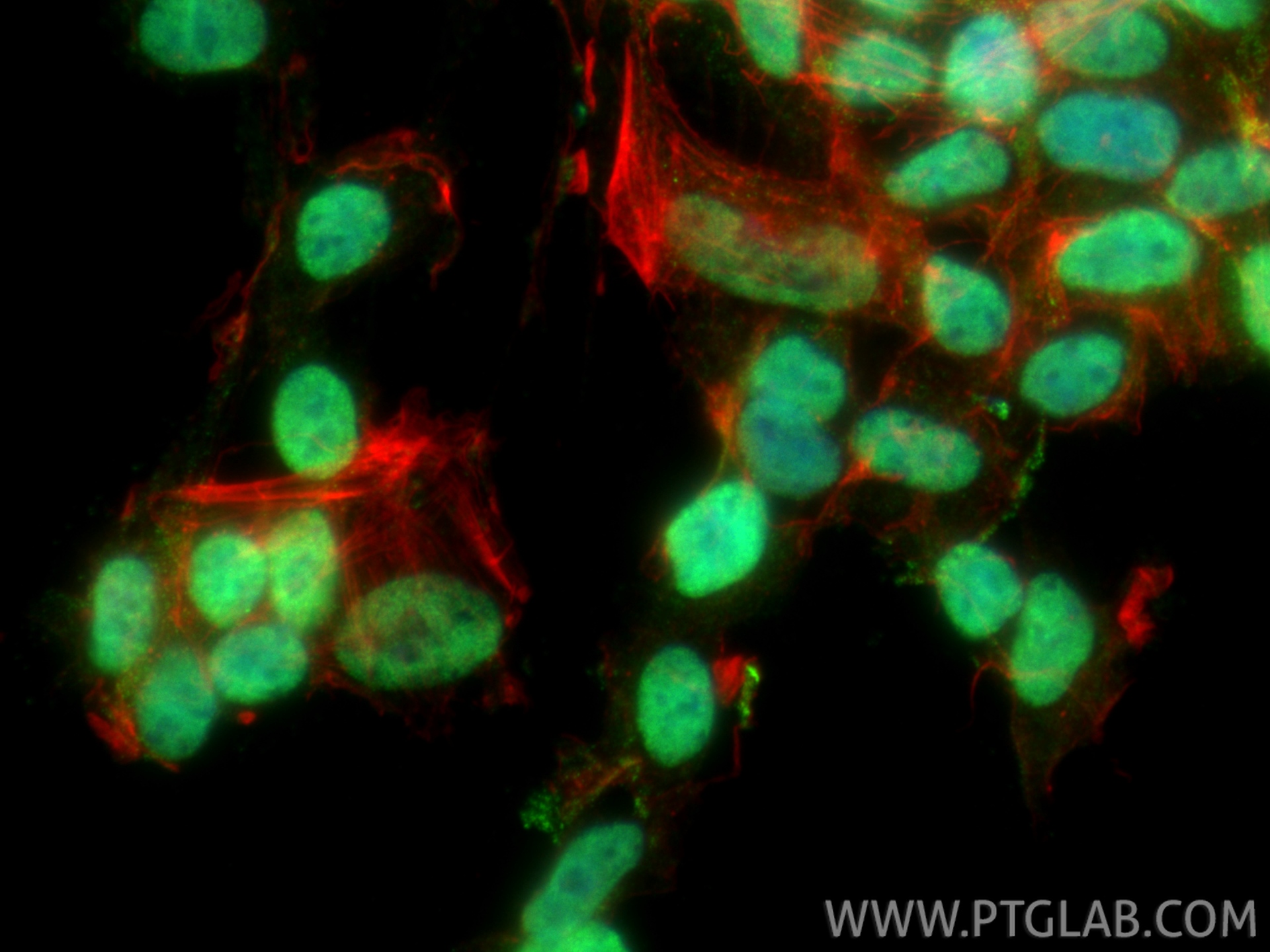 Immunofluorescent analysis of (4% PFA) fixed SH-SY5Y cells using PHOX2B antibody (25276-1-AP) at dilution of 1:400 and CoraLite®488-Conjugated Goat Anti-Rabbit IgG(H+L) (<a class='green' href='/productredirect?CatalogNo=SA00013-2' target='_blank'>SA00013-2</a>), CL594-phalloidin (red). IF Staining of SH-SY5Y using 25276-1-AP