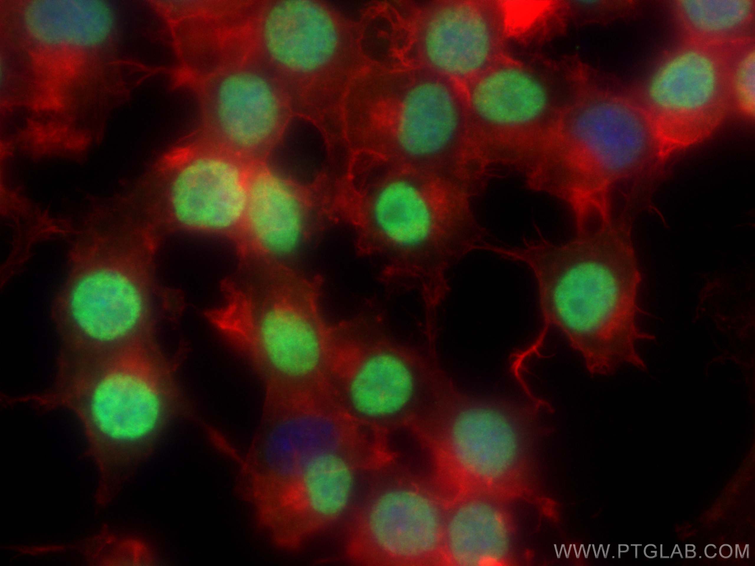 IF Staining of Neuro-2a using 66254-1-Ig