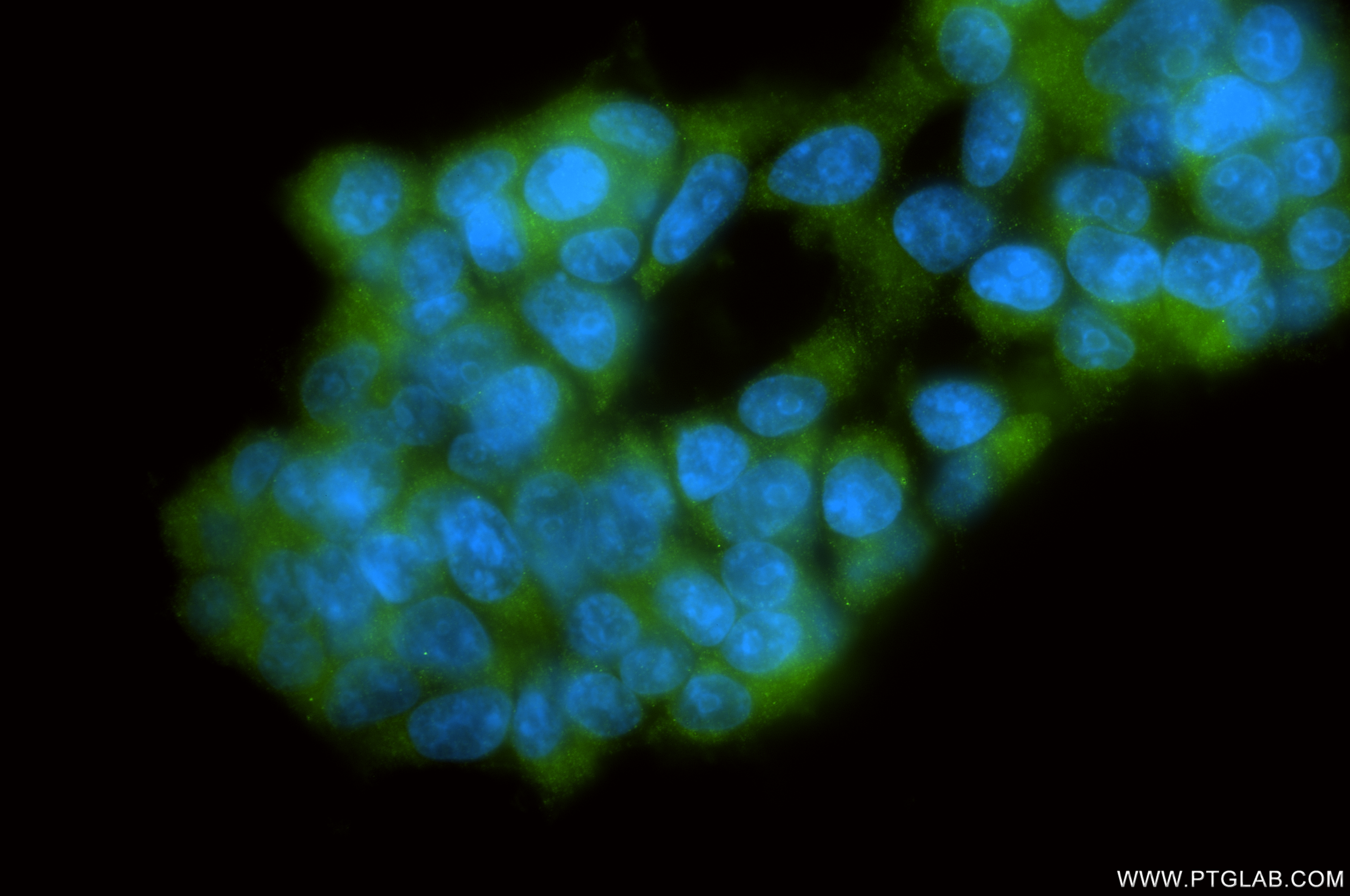 IF Staining of HEK-293 using 86736-3-RR (same clone as 86736-3-PBS)