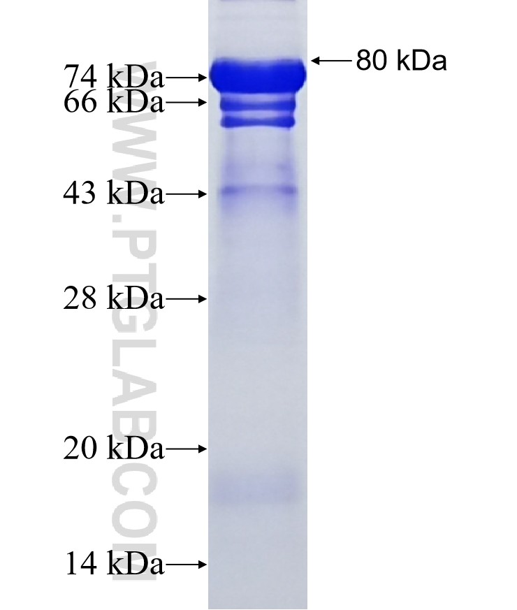 PHRF1 fusion protein Ag20048 SDS-PAGE PHRF1 fusion protein Ag20048 SDS-PAGE
