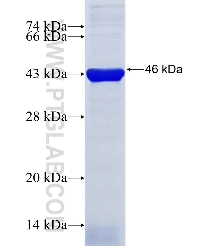 PHTF1 fusion protein Ag7183 SDS-PAGE PHTF1 fusion protein Ag7183 SDS-PAGE