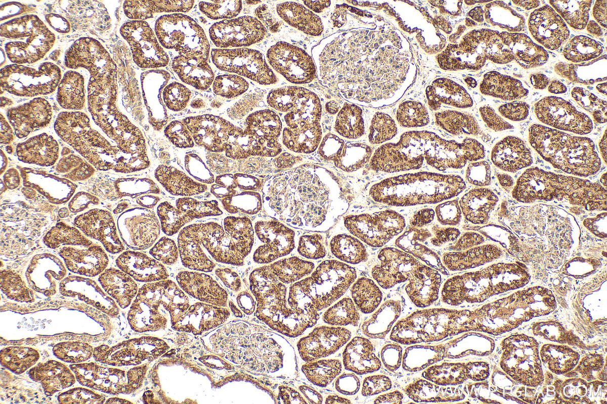 IHC staining of human kidney using 12858-1-AP