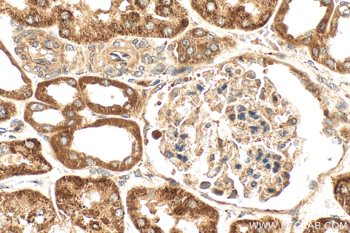 IHC staining of human kidney using 12858-1-AP
