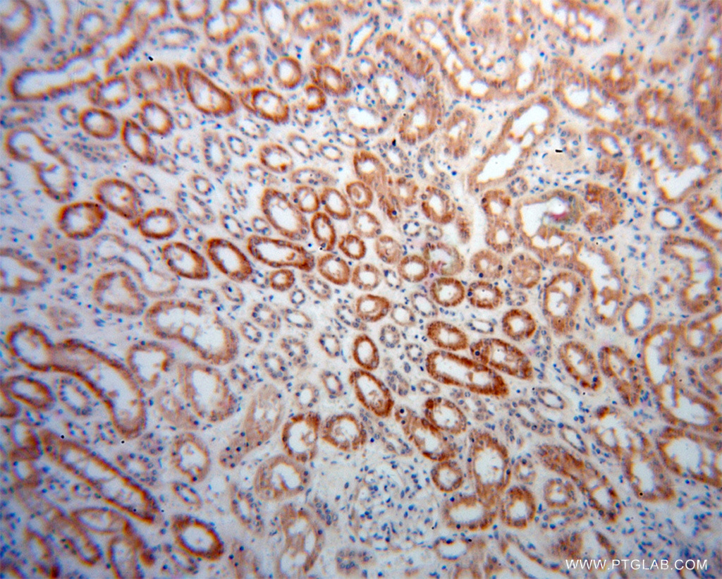 IHC staining of human kidney using 12858-1-AP