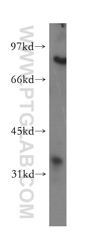 WB analysis of human liver using 12858-1-AP