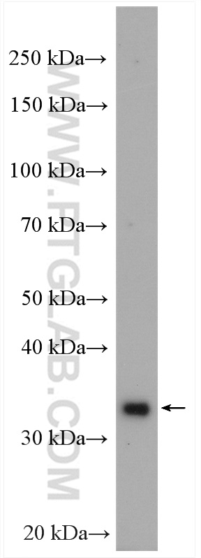 WB analysis of mouse brain using 16984-1-AP