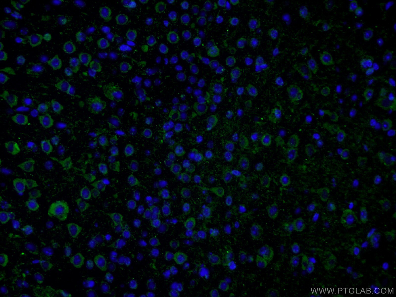 IF Staining of mouse brain using 16937-1-AP