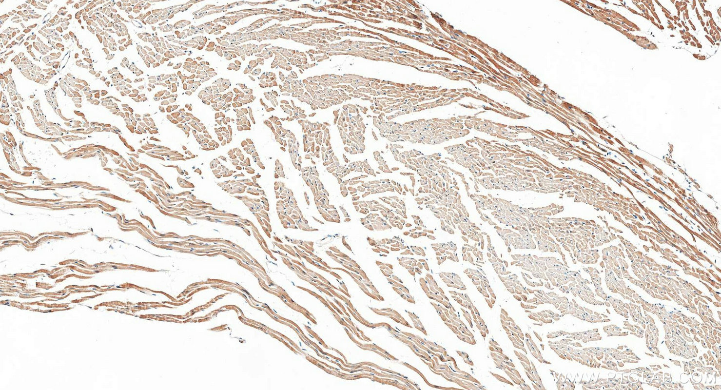 IHC staining of mouse heart using 30527-1-AP IHC staining of mouse heart using 30527-1-AP