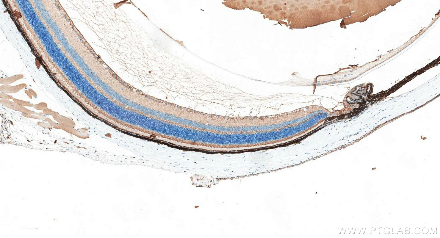 IHC staining of mouse eye using 30527-1-AP IHC staining of mouse eye using 30527-1-AP