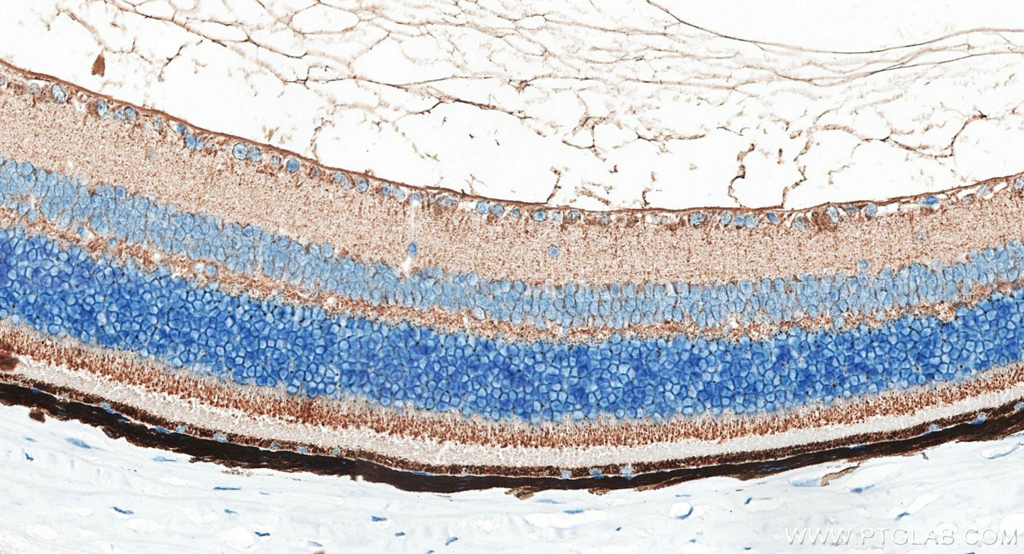 IHC staining of mouse eye using 30527-1-AP IHC staining of mouse eye using 30527-1-AP