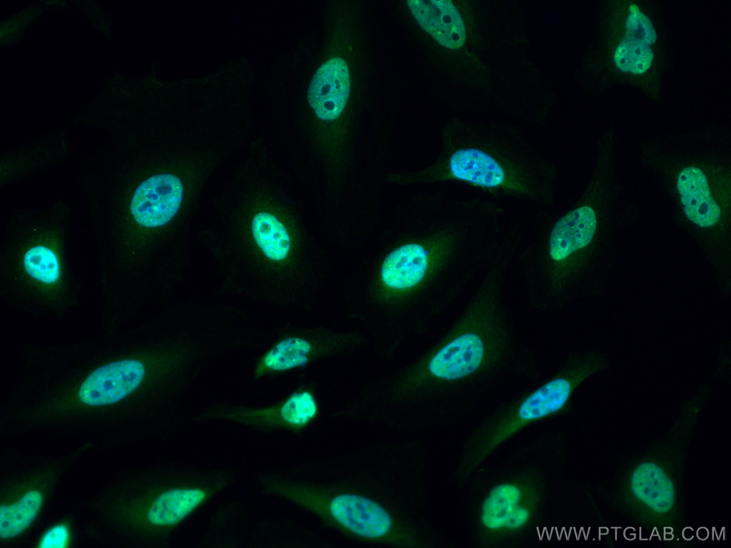 IF Staining of HeLa using CL488-20584